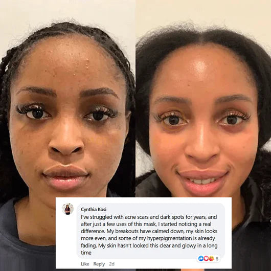 ✨ Collagen Night Wrapping Mask Experience visibly smoother, firmer skin within hours—thanks to our breakthrough formula with 3X more ultra-absorbable collagen.